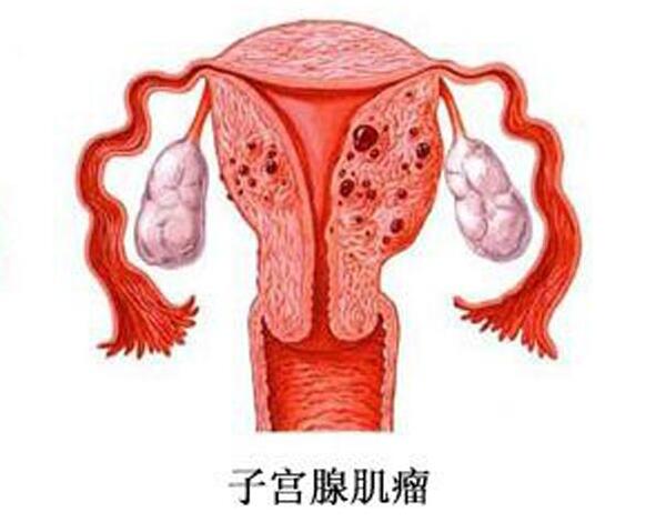 头条顾问：借卵做试管自怀促排卵期间的注意事项和饮食习惯