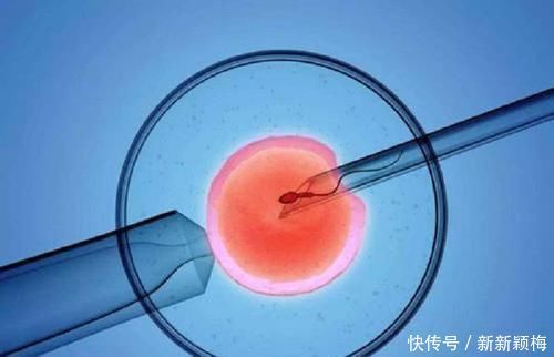 北京做供卵试管婴儿哪家医院好