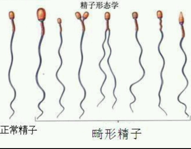 无卵试管费用高吗