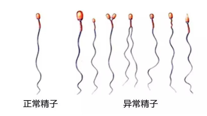 6个月孕妇一平躺下来就有胎动是男孩吗